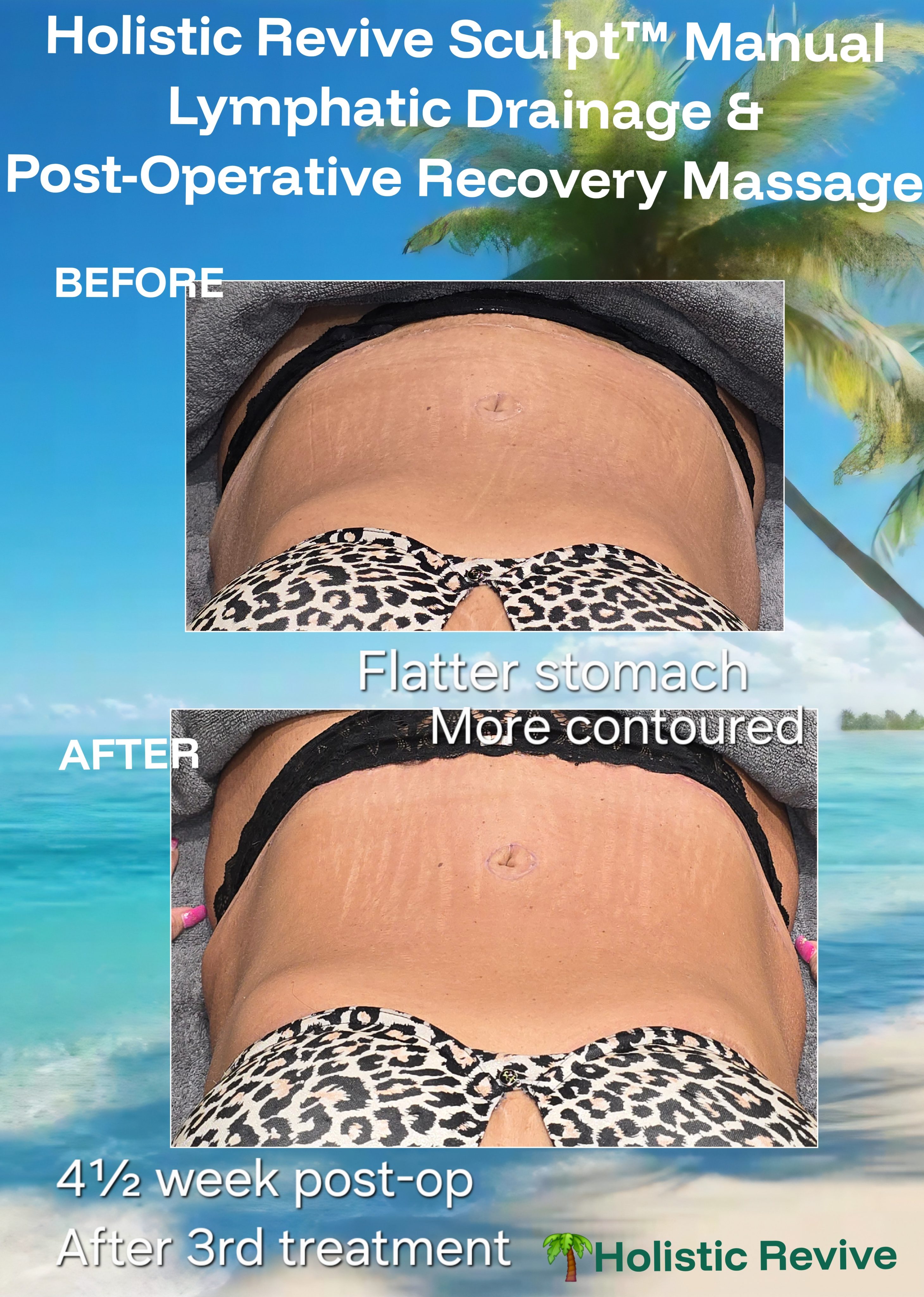 Why Combining Lymphatic Drainage Techniques Creates Better Results