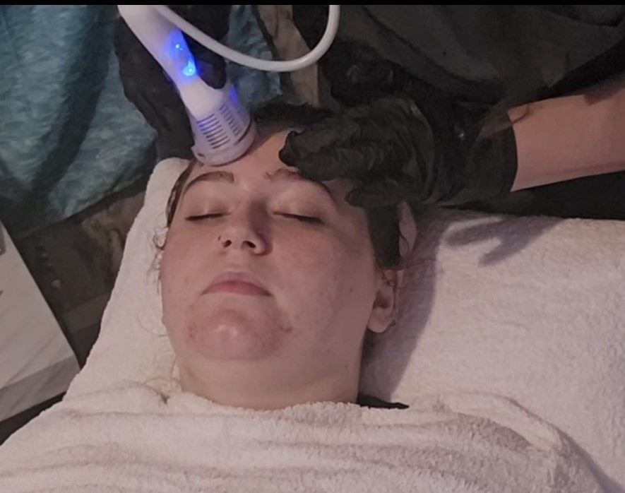 What Is a HydroFacial & Does It Really Work?