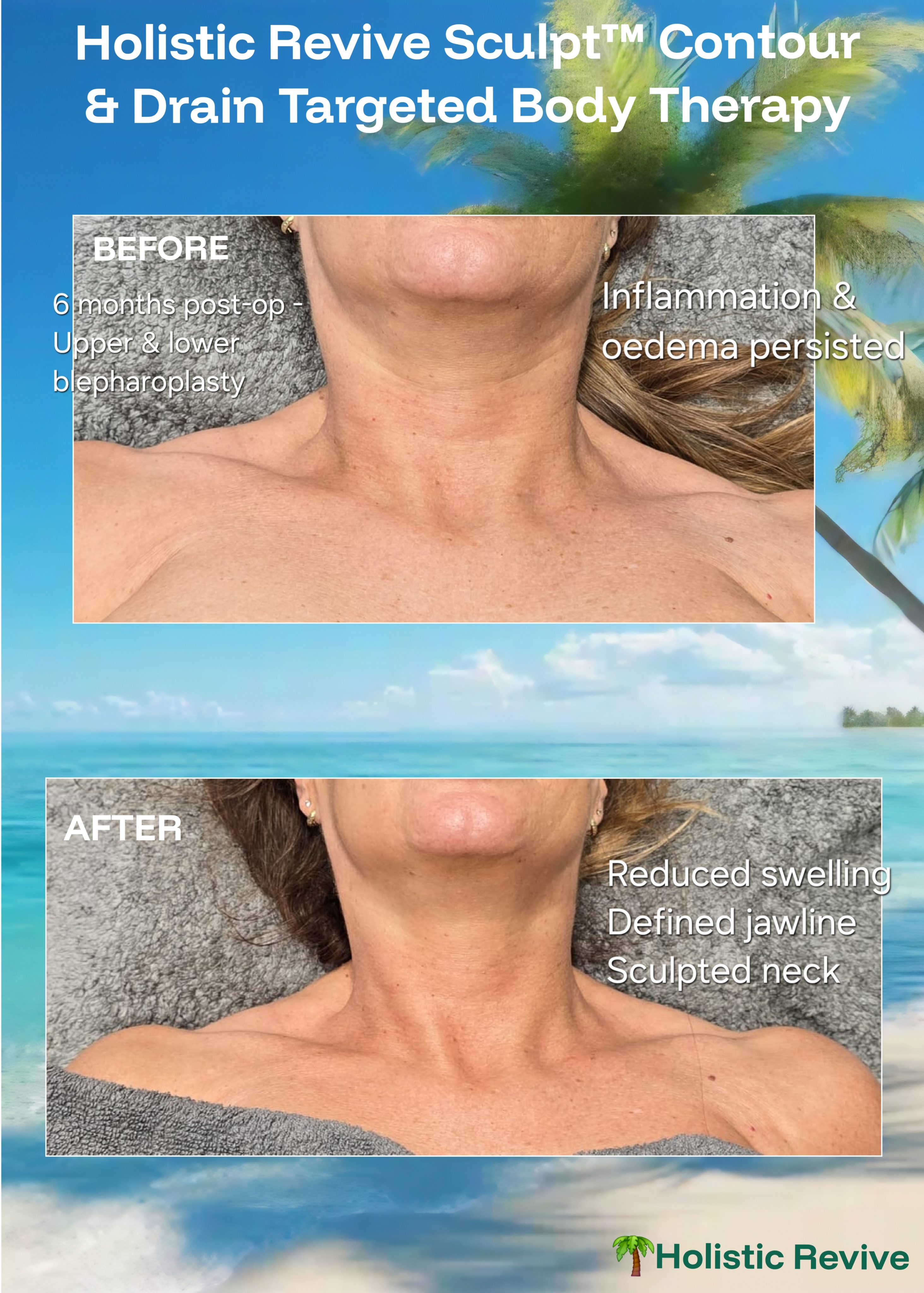 Not All Lymphatic Drainage Is the Same – Here’s Why That Matters