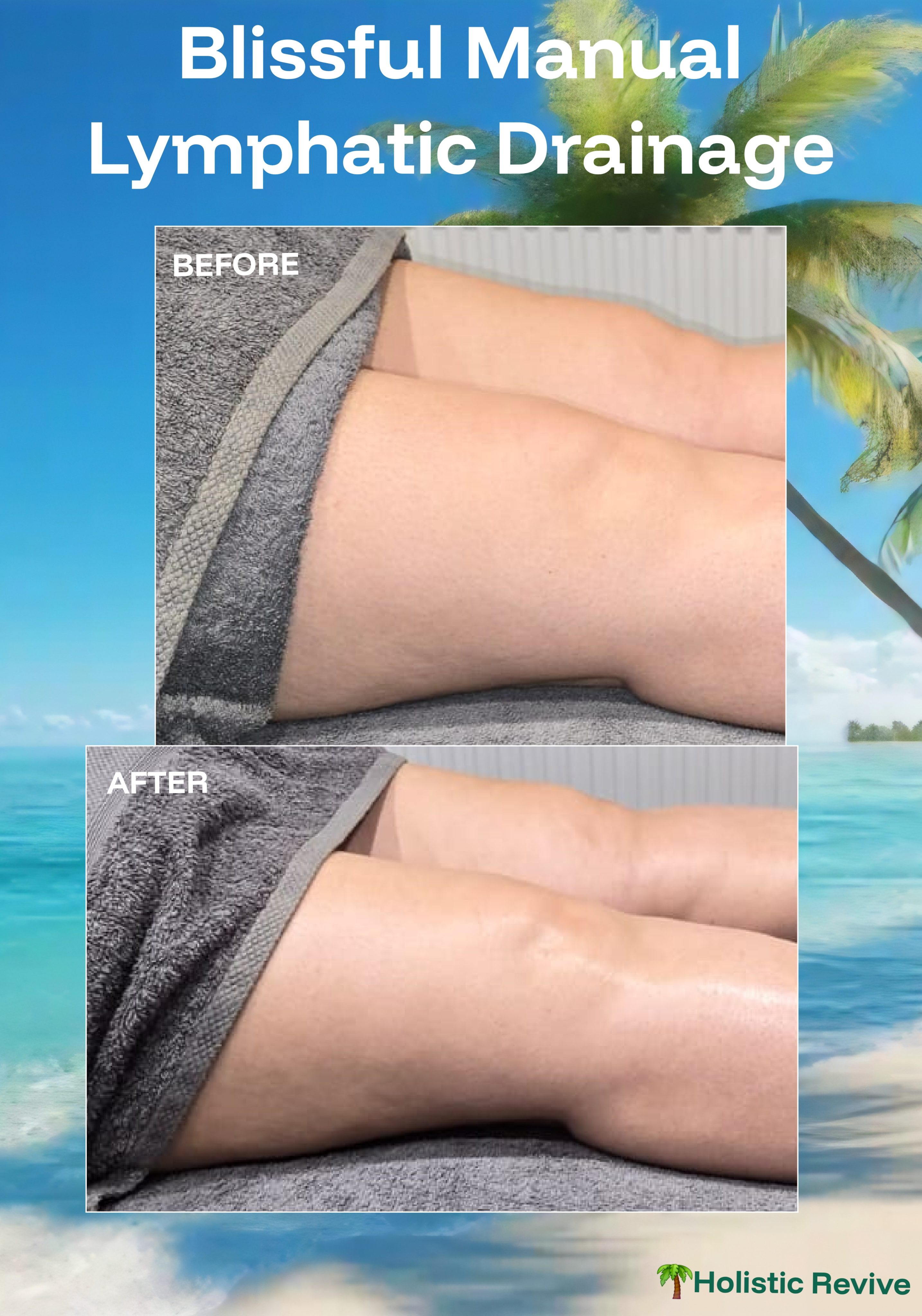 Manual Lymphatic Drainage (MLD) & What It Is?